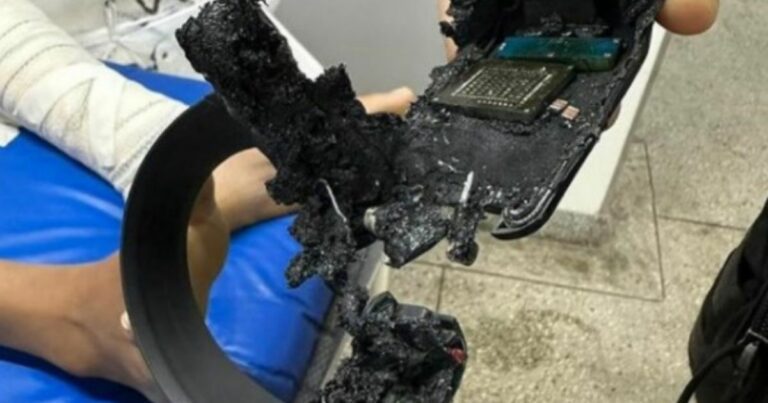 Tornozeleira eletrônica explode e fere mulher em Natal