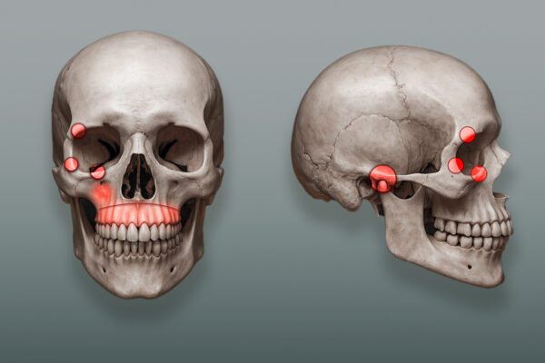 Veja onde foram as lesões no rosto de mulher socada 61 vezes por ex