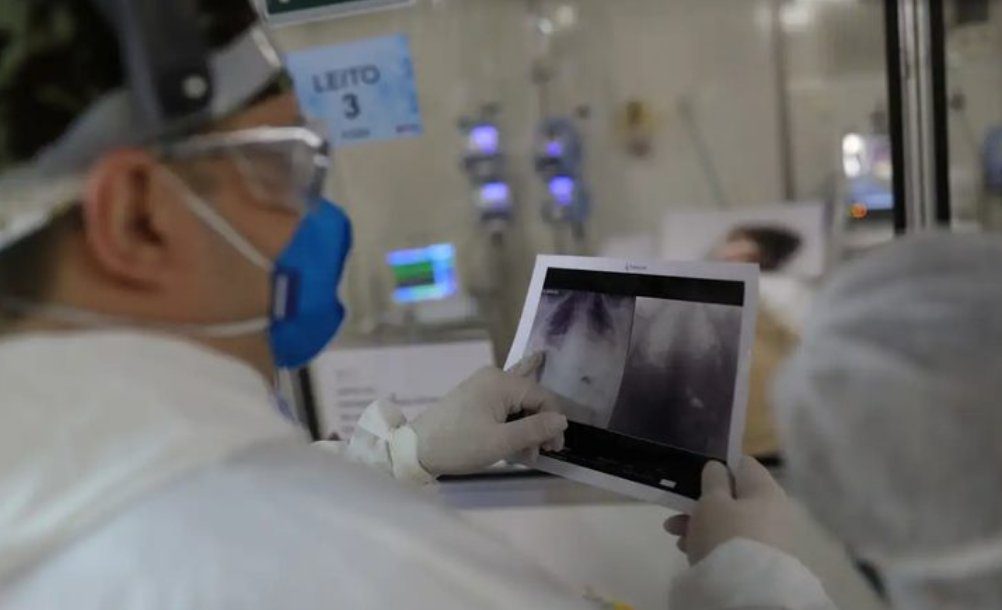 Covid-19 causou a maioria das mortes por síndrome respiratória em setembro