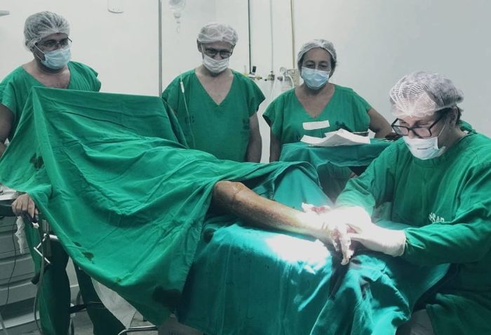 No momento, você está visualizando Hospital de Pau dos Ferros realiza mutirão de cirurgias ortopédicas